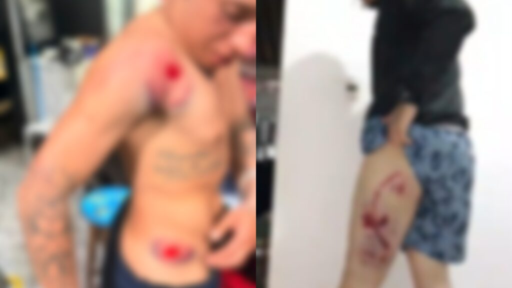 agressão após jogo do Brasil Moradores da comunidade Vale dos Machados, em Guaru