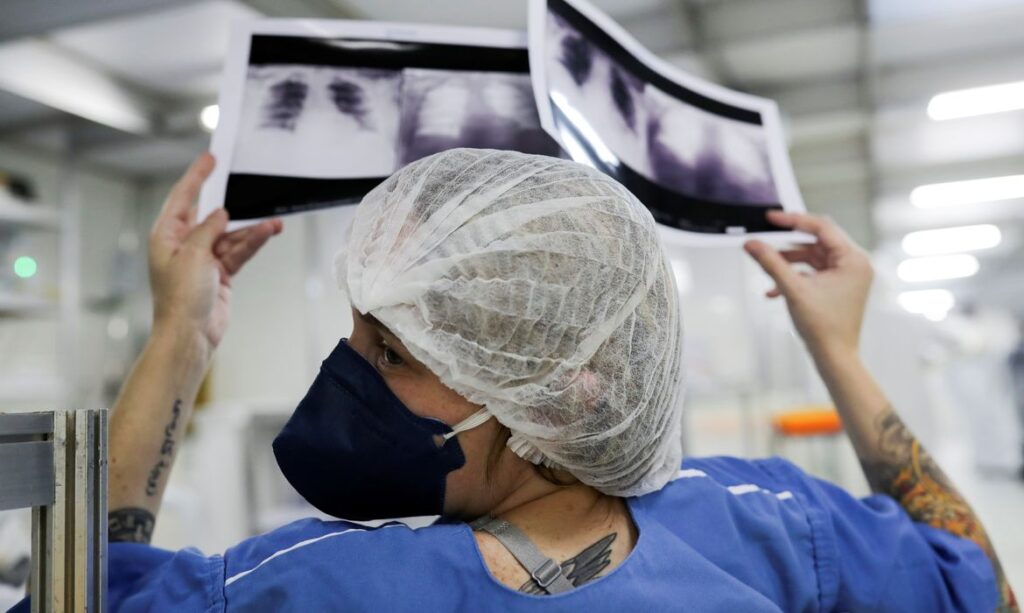 Detecção precoce é essencial para aumentar sobrevida de pacientes com câncer de pulmão no SUS