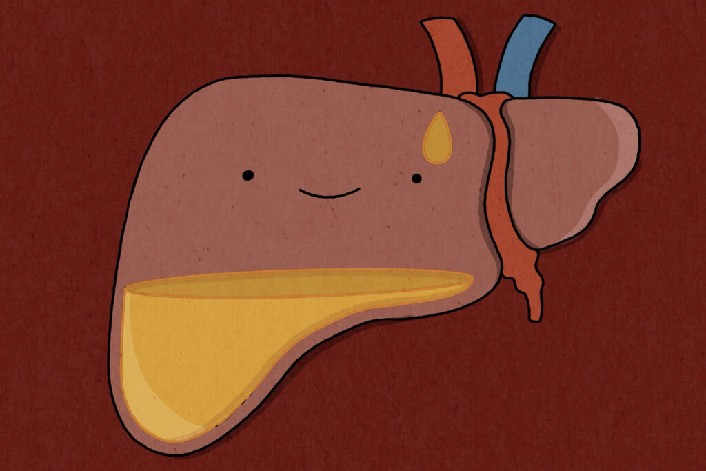 Esteatose hepática: entenda o que é gordura no fígado e como identificar os riscos