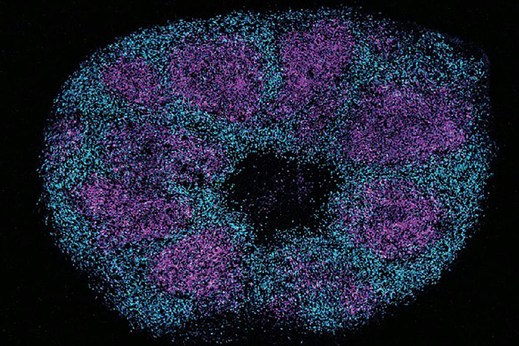 Estudo de proteínas cerebrais abre caminho para novos tratamentos do autismo