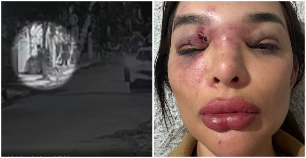 Polícia investiga omissão de seguranças em caso de agressão contra dentista em São Paulo