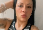 Laudo pericial detalha morte de mulher após colonoscopia com intestino perfurado em hospital de São Paulo