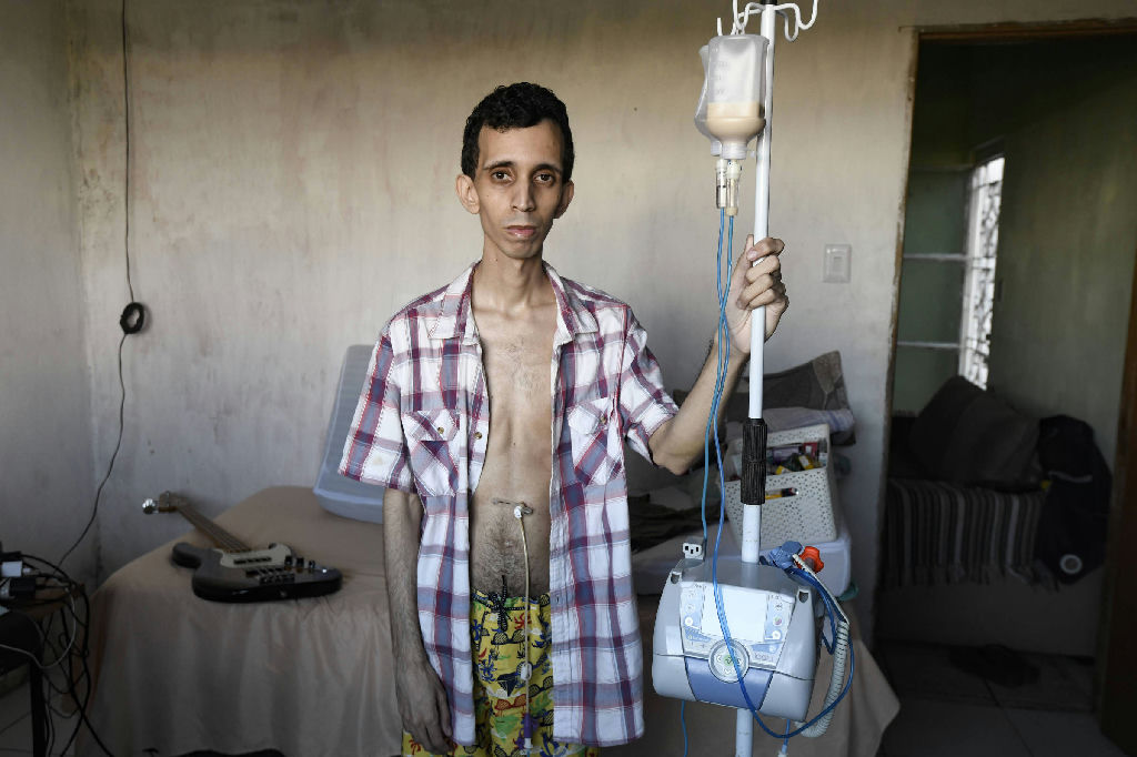 A odisseia do diagnóstico: pacientes com doenças raras enfrentam anos de incerteza no Brasil