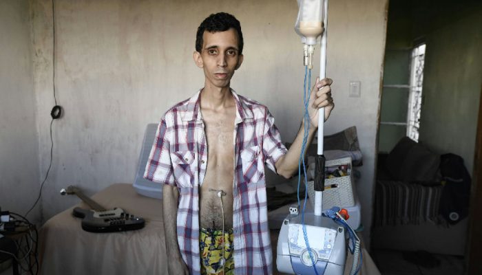 A odisseia do diagnóstico: pacientes com doenças raras enfrentam anos de incerteza no Brasil