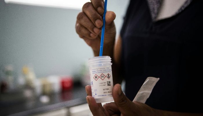 Autocoleta de Dna-hpv rompe barreiras geográficas no combate ao câncer cervical