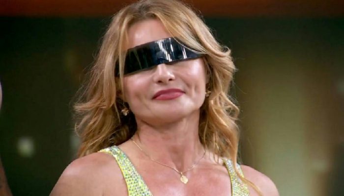 Blefaroplastia: Rita Guedes expõe risco de visão e alerta para complicações da cirurgia
