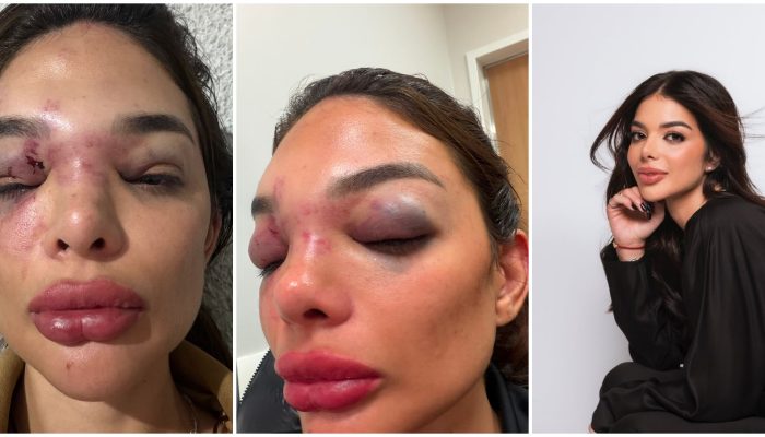 Dentista relata omissão de seguranças durante agressão cometida por empresário em São Paulo