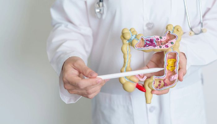 Doenças inflamatórias intestinais disparam no Brasil com alta de 427% em 13 anos