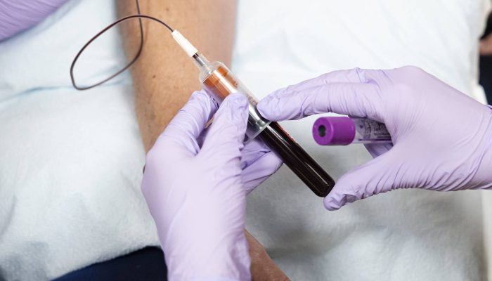Enlicitida: o novo comprimido para colesterol que dispensa injeções