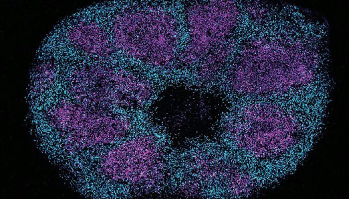 Estudo de proteínas cerebrais abre caminho para novos tratamentos do autismo