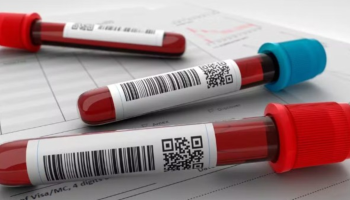 meio de um exame de sangue. O estudo busca voluntárias entre 30 e 80 anos, sem h