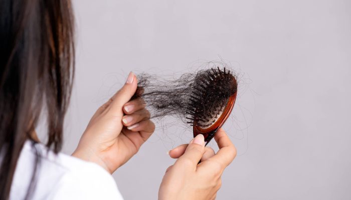 Queda de cabelo no inverno: a conexão inesperada com infecções respiratórias