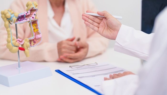 Câncer colorretal: brasileiros adiam busca por diagnóstico precoce, aponta estudo