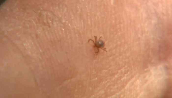 Febre maculosa: morte em São Bernardo do Campo acende alerta e expõe riscos da doença