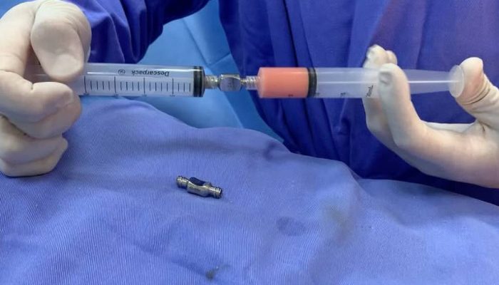 Nanofat: a técnica de enxerto de gordura que promete rejuvenescimento divide opiniões médicas