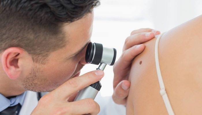 Vacina para cancer de pele renova fe na genomica e nos avancos da biologia